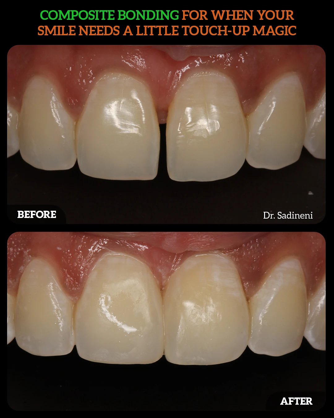 528975818_18525036322010625_1806105672038638005_n