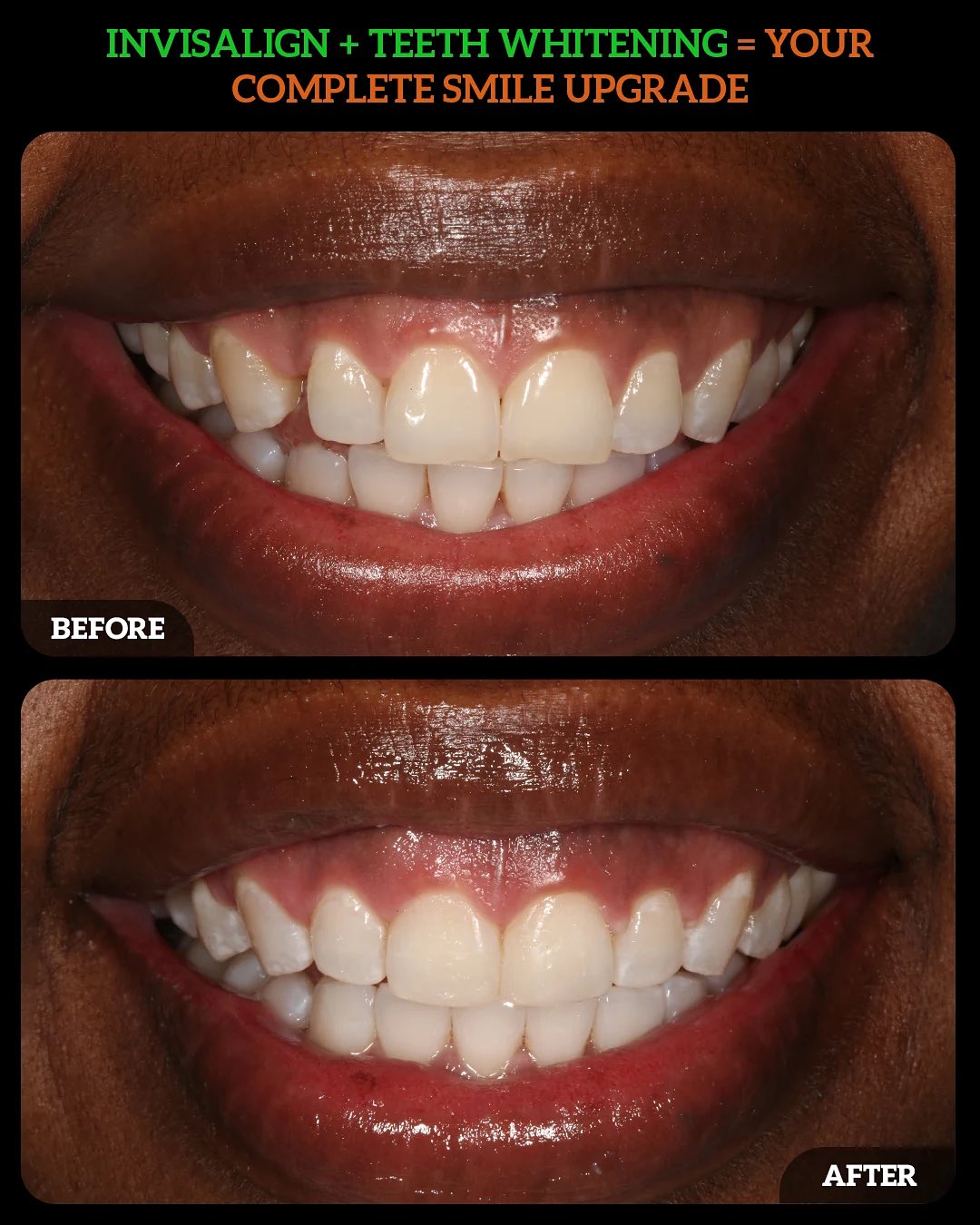 550411666_18533159497010625_5129355589619236400_n