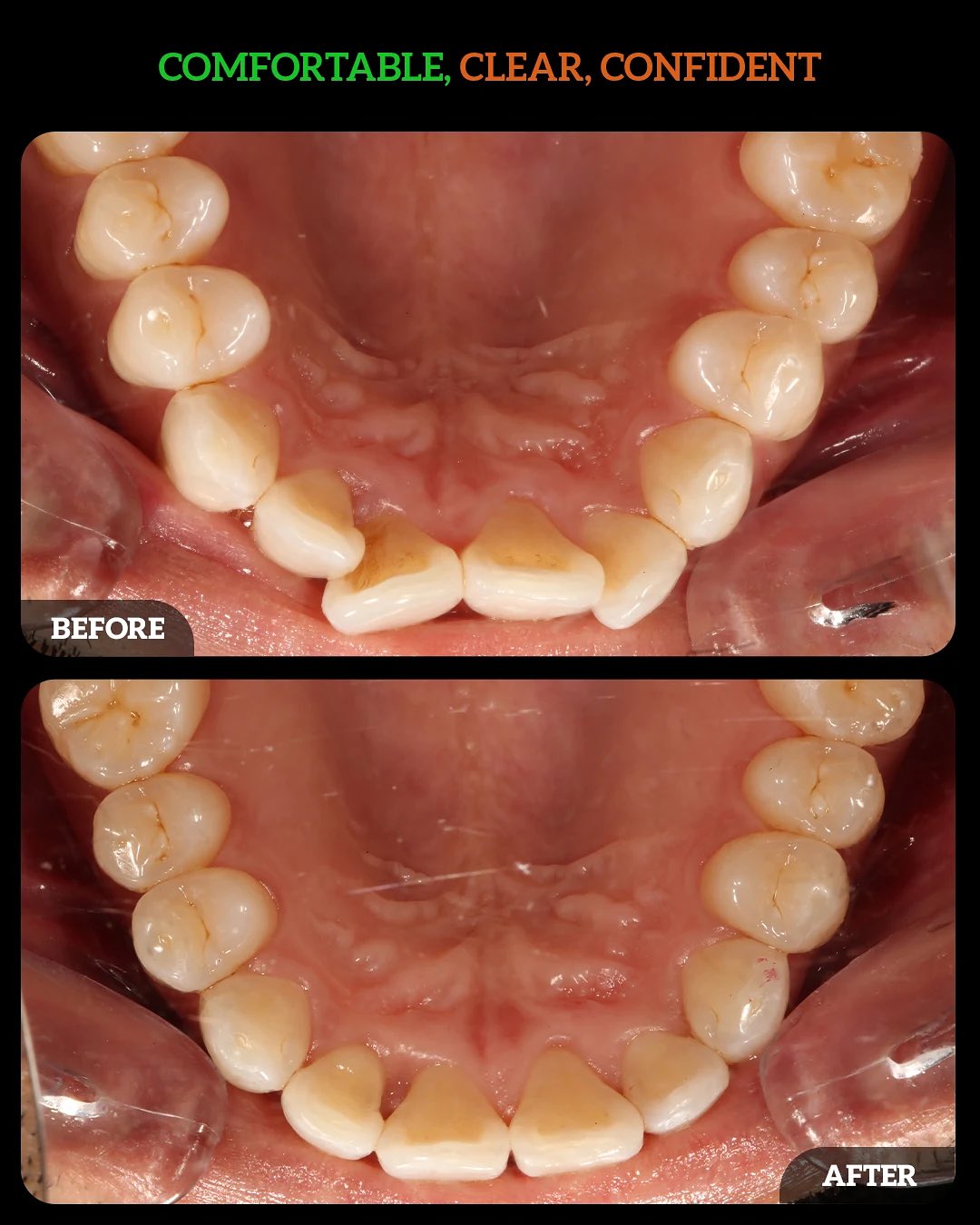 552968007_18533887747010625_6836986761765401824_n