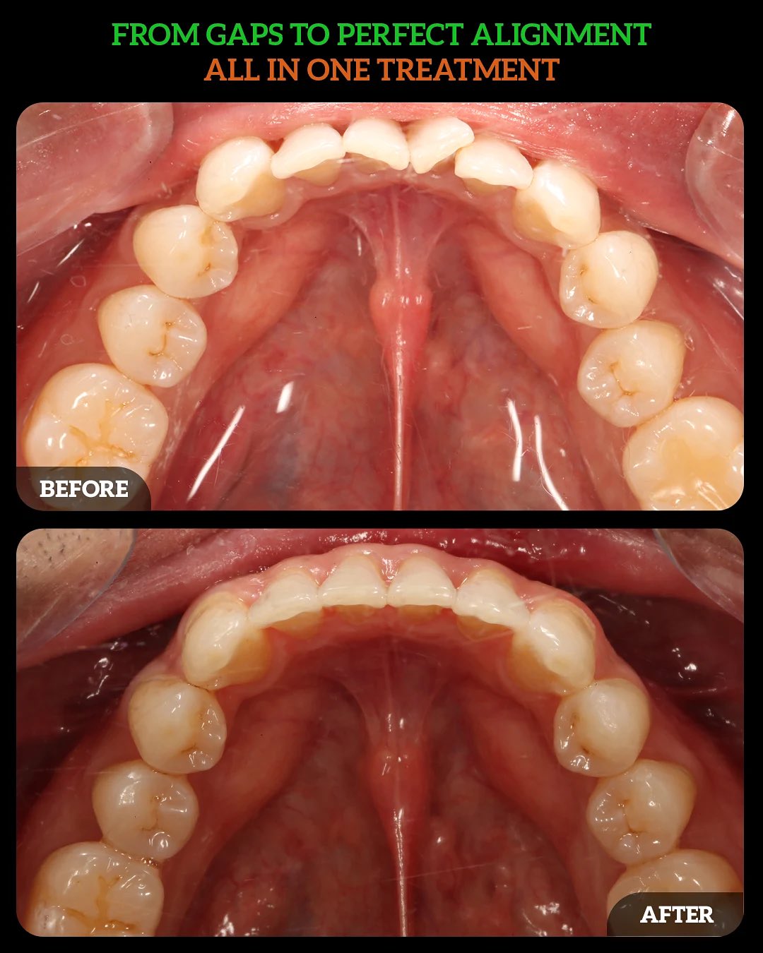 553087768_18533887702010625_1888154975077962075_n