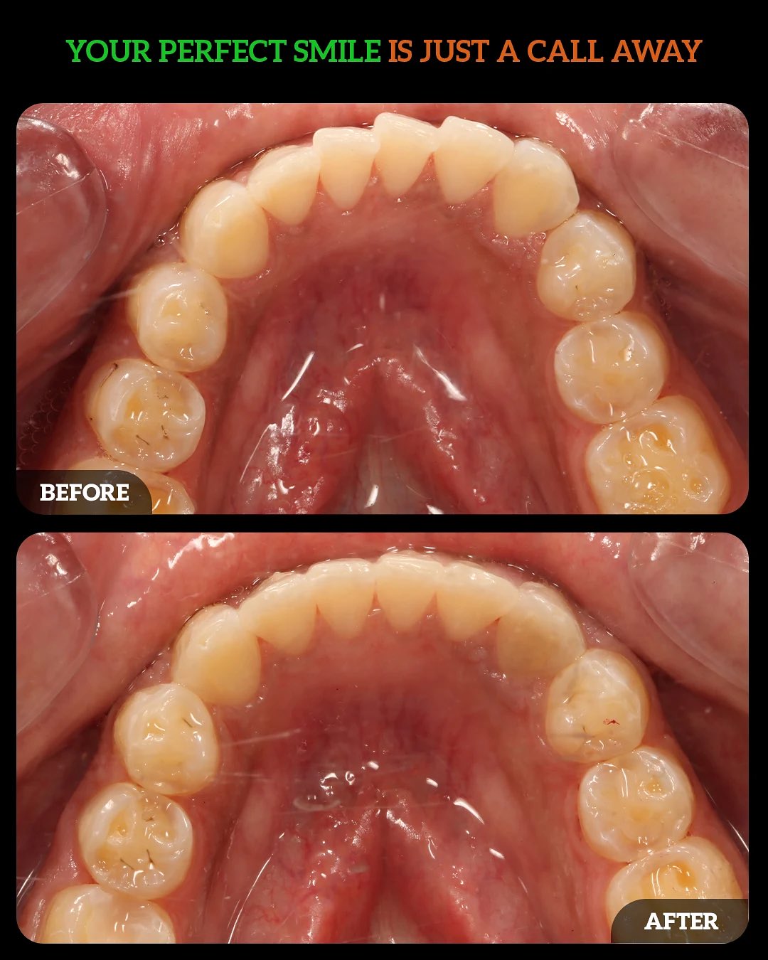 557855830_18536003344010625_3836915850780832549_n