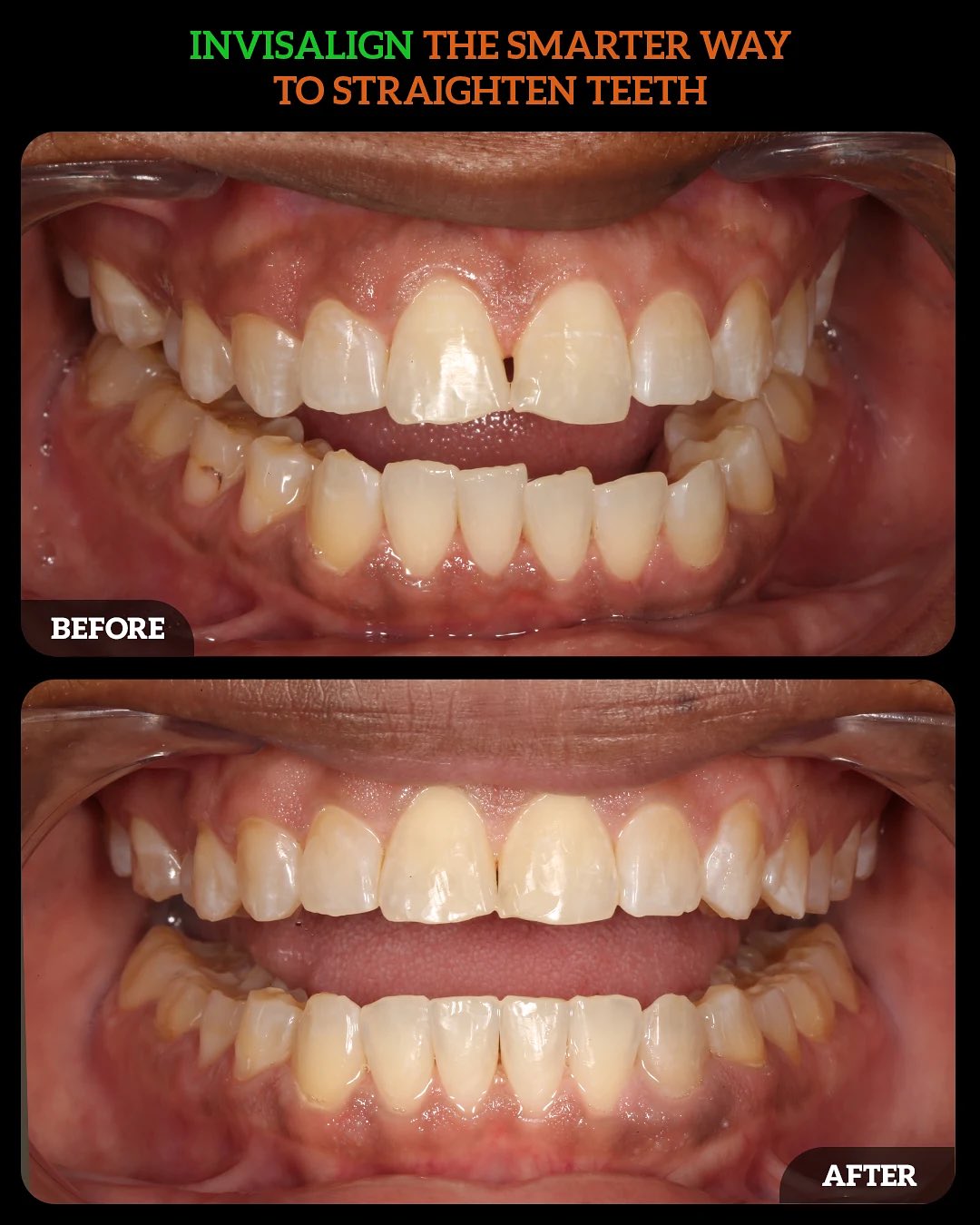 559281275_18536003296010625_7207072805195366148_n