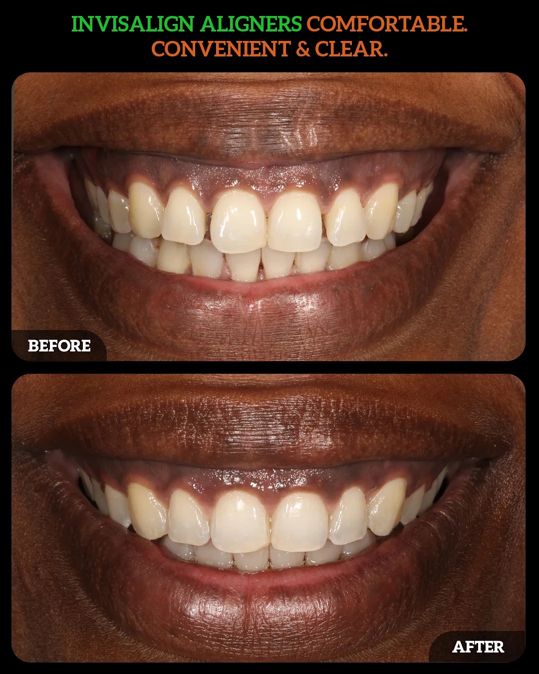 561356475_18537206602010625_2152366583984986785_n