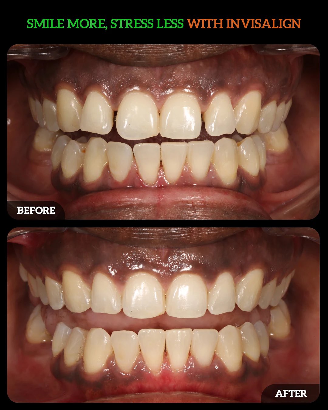 563183735_18537206623010625_2140873788758028518_n