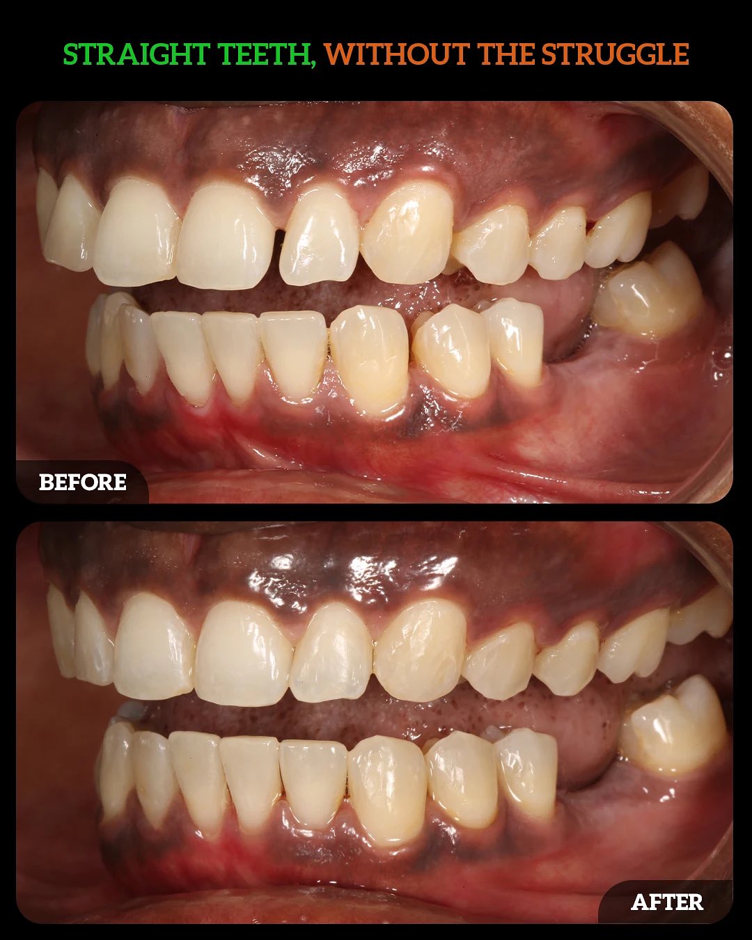 563887841_18537206614010625_300360181801079708_n