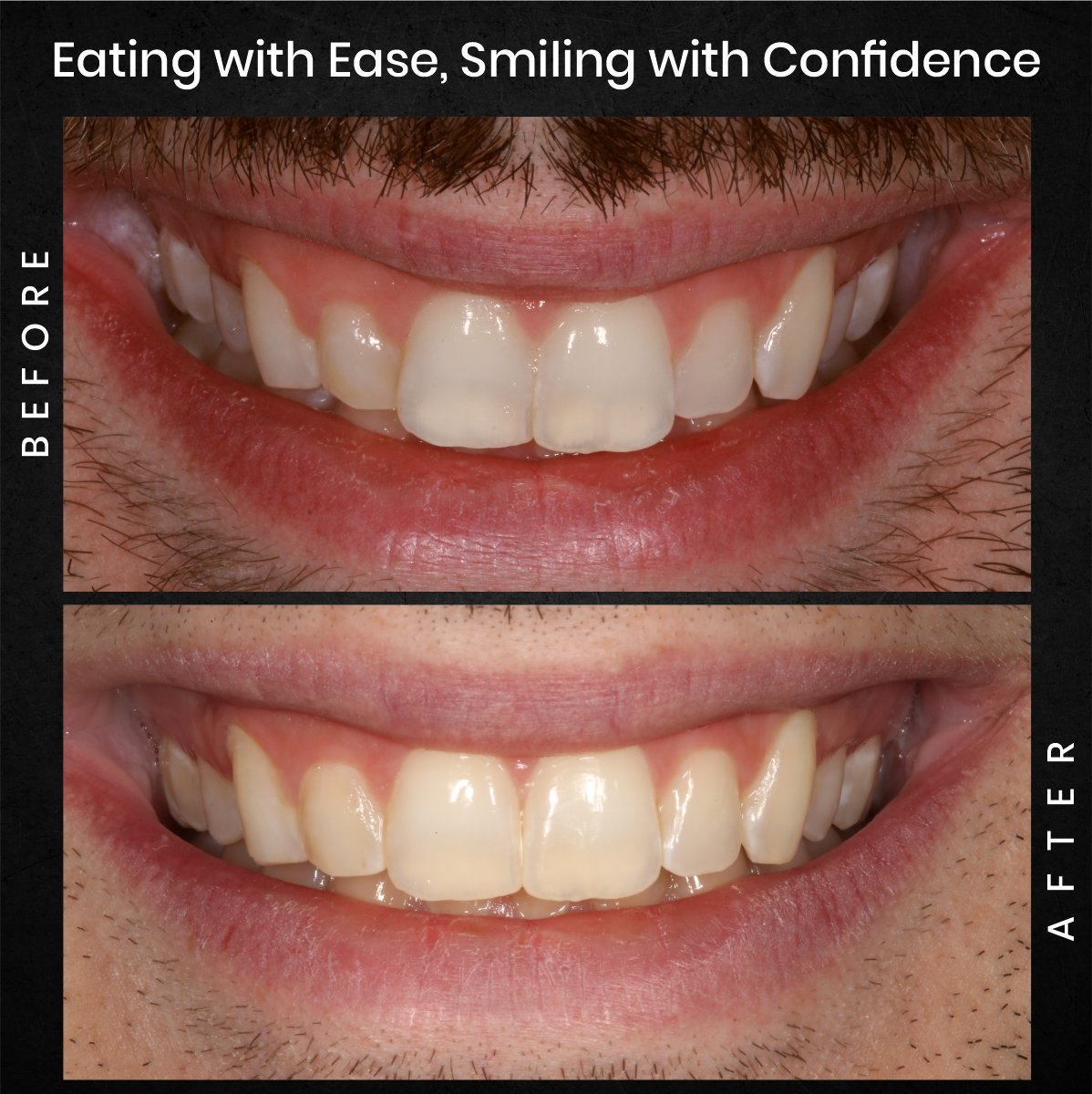 DMD AUG POST 16 B&A CAROUSEL ADAM BARSTOW_4