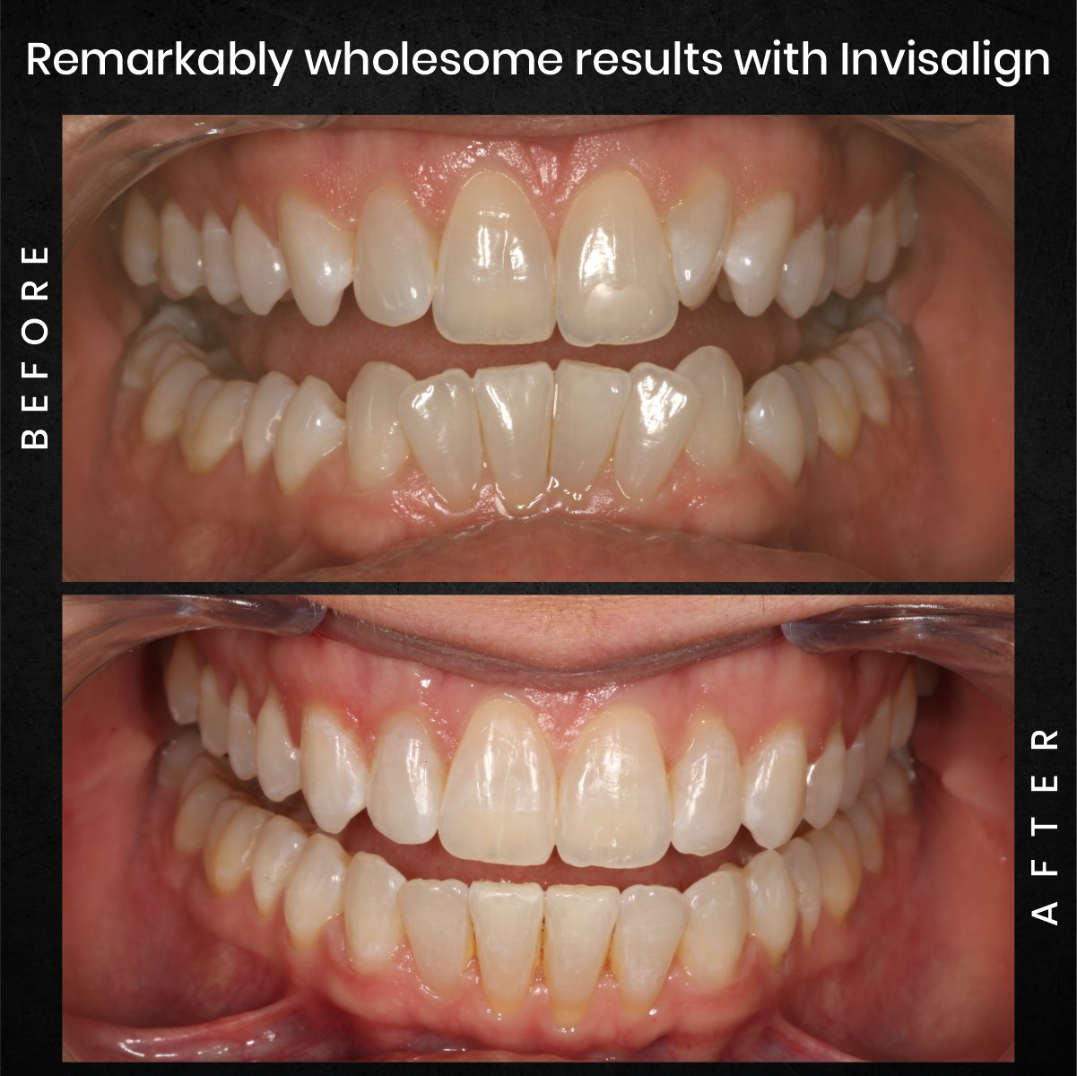 DMD AUG POST 18 B&A CAROUSEL MELISSA CLOSSER_4