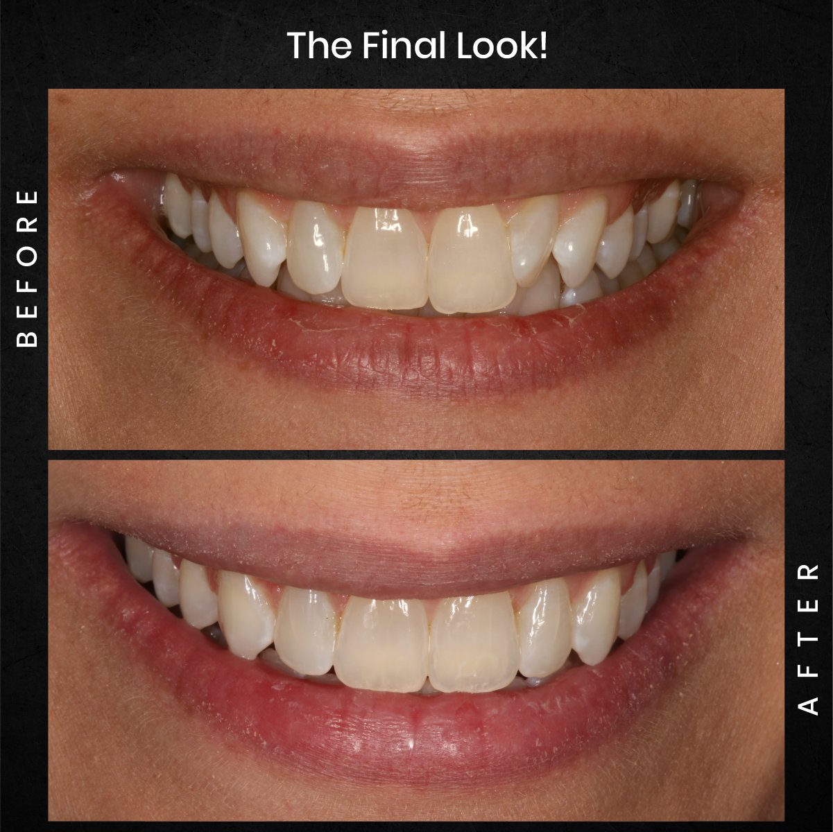 DMD AUG POST 18 B&A CAROUSEL MELISSA CLOSSER_5