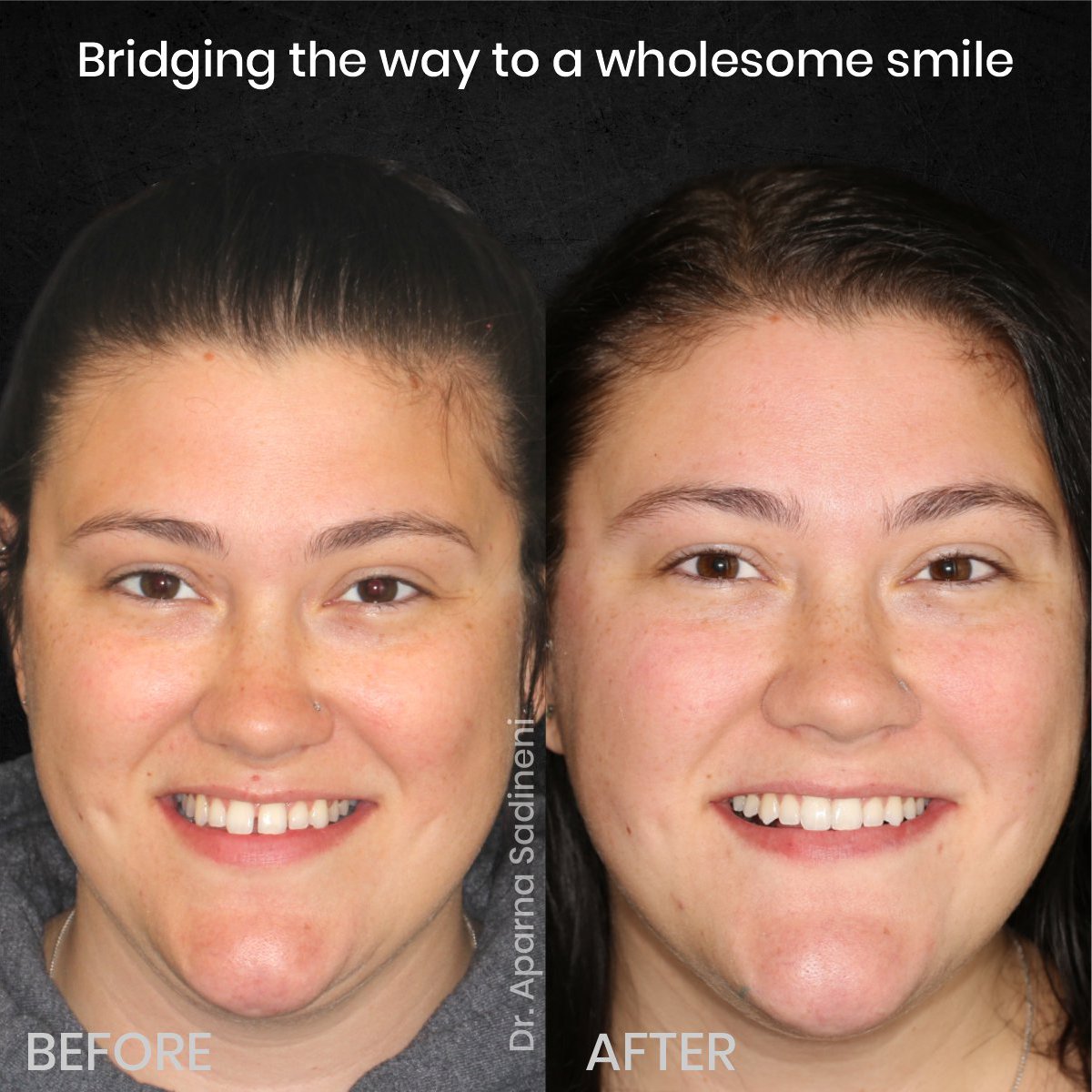 DMD AUG POST 28 B&A CAROUSEL HAYLEY STAKEM_1