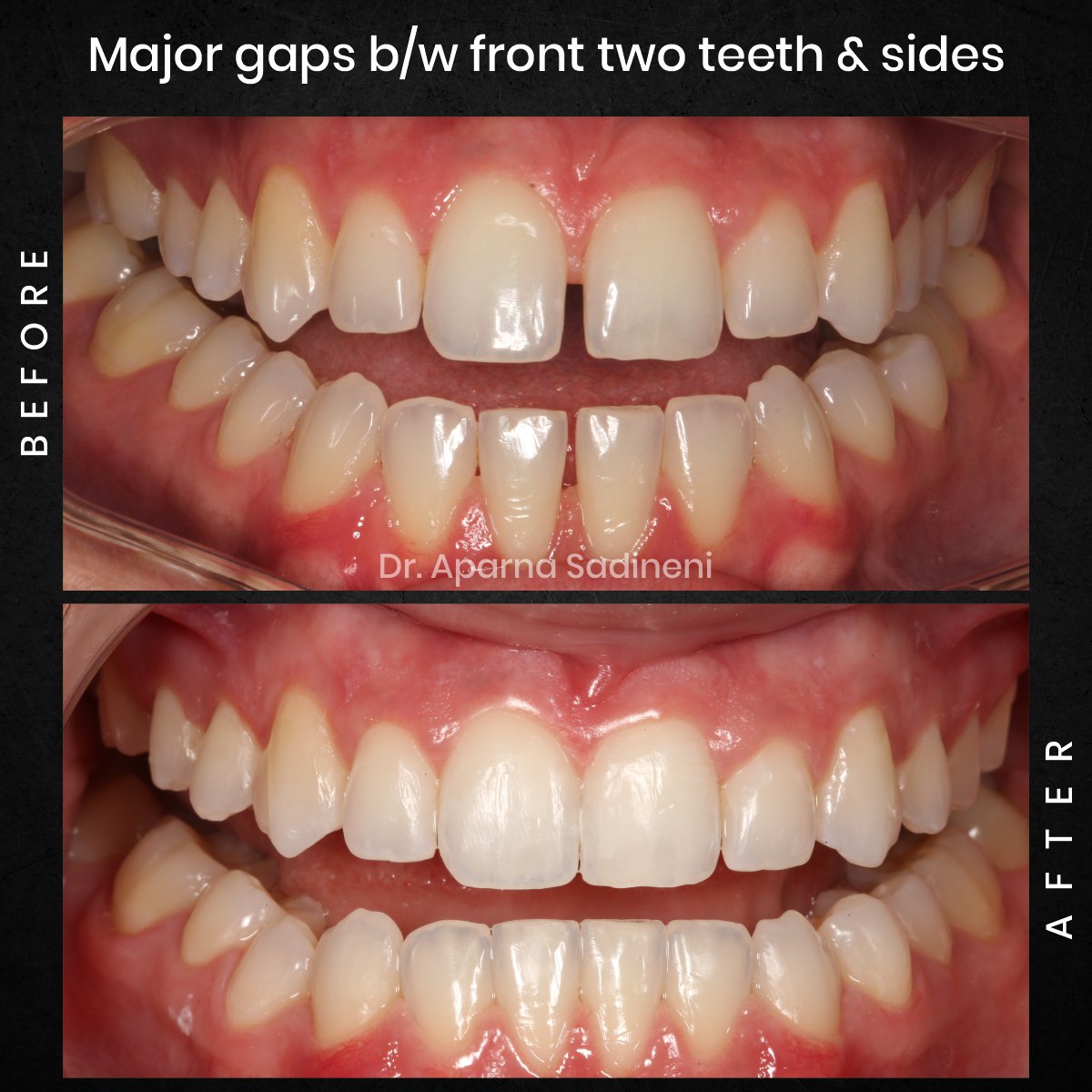 DMD AUG POST 28 B&A CAROUSEL HAYLEY STAKEM_2