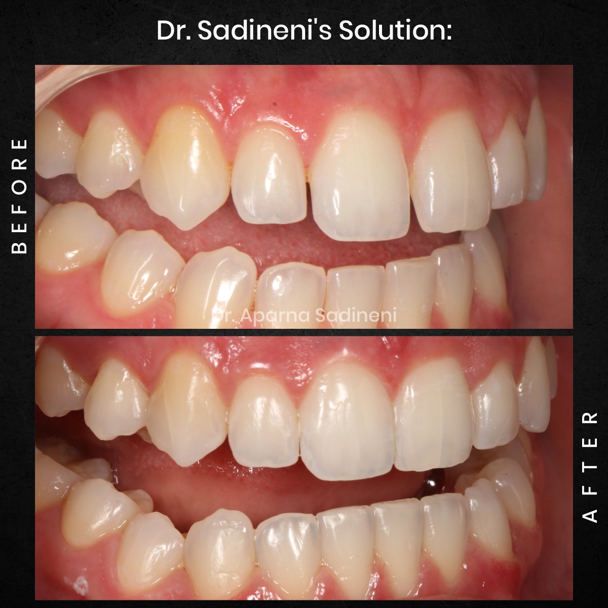 DMD AUG POST 28 B&A CAROUSEL HAYLEY STAKEM_3