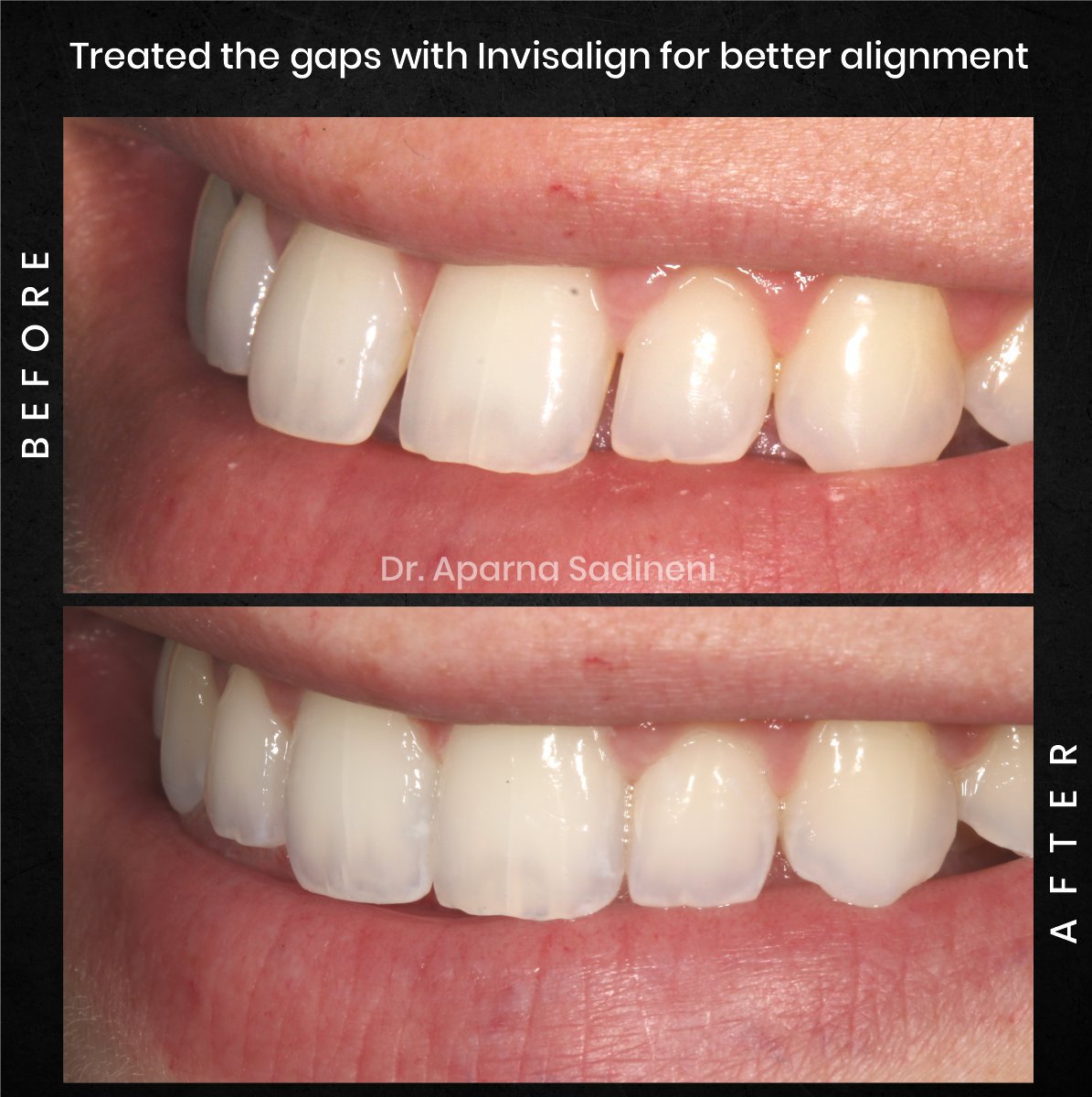 DMD AUG POST 28 B&A CAROUSEL HAYLEY STAKEM_4