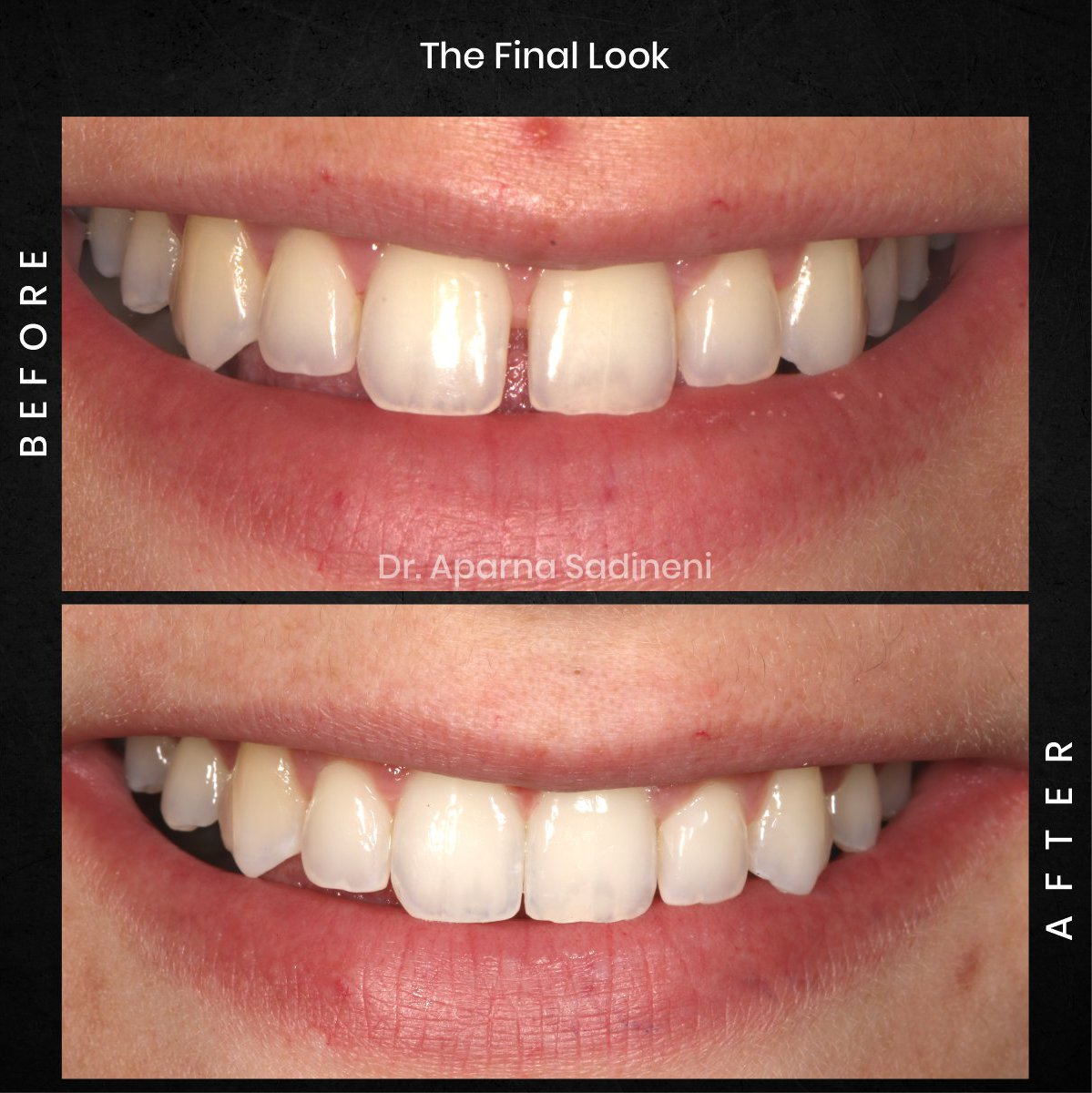 DMD AUG POST 28 B&A CAROUSEL HAYLEY STAKEM_5