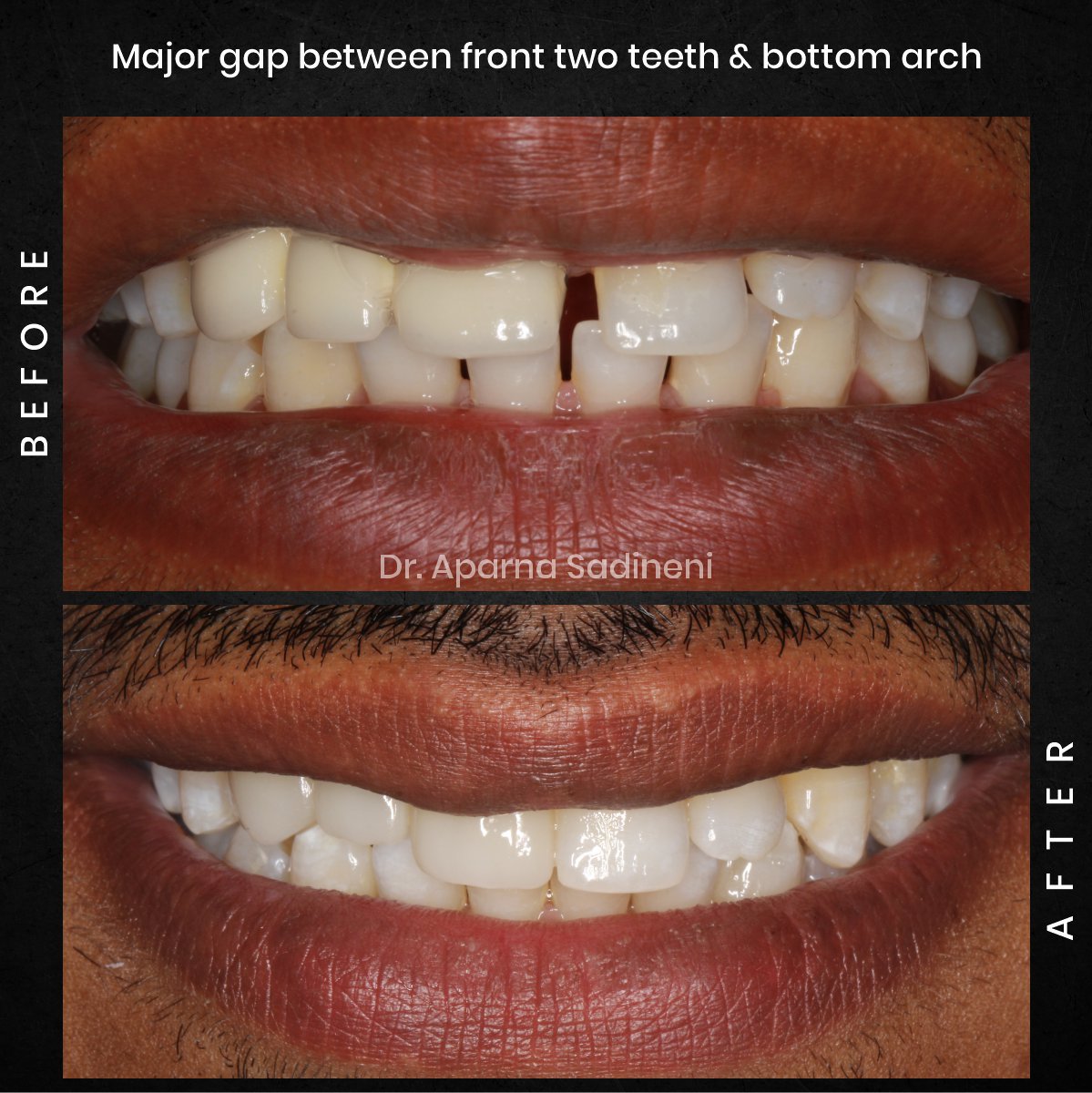 DMD CYCLE 3 POST 1 CAROUSEL B&A BHARATH_2