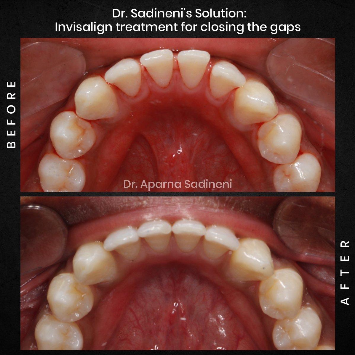DMD CYCLE 3 POST 1 CAROUSEL B&A BHARATH_3