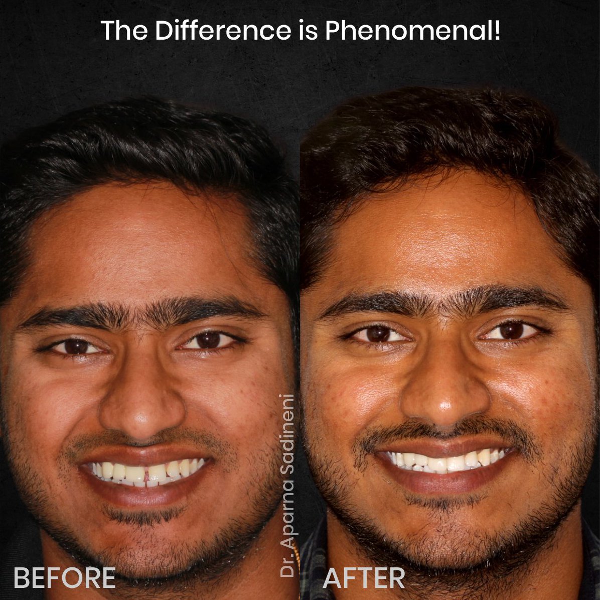 DMD CYCLE 3 POST 1 CAROUSEL B&A BHARATH_4