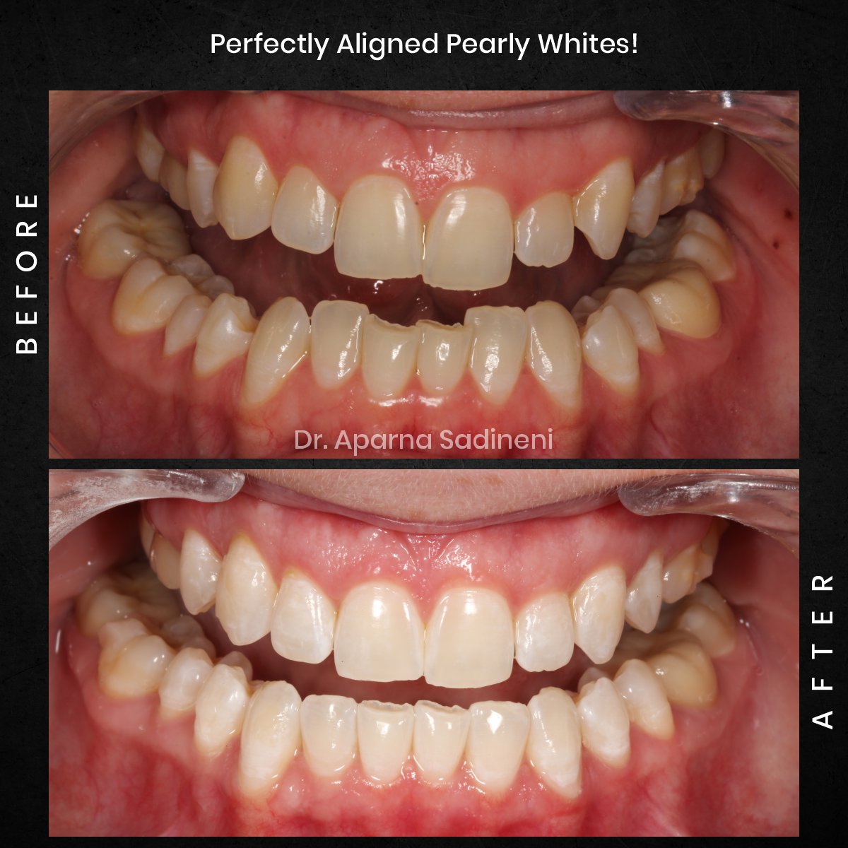 DMD CYCLE 3 POST 3 B&A CAROUSEL AMBER P._1