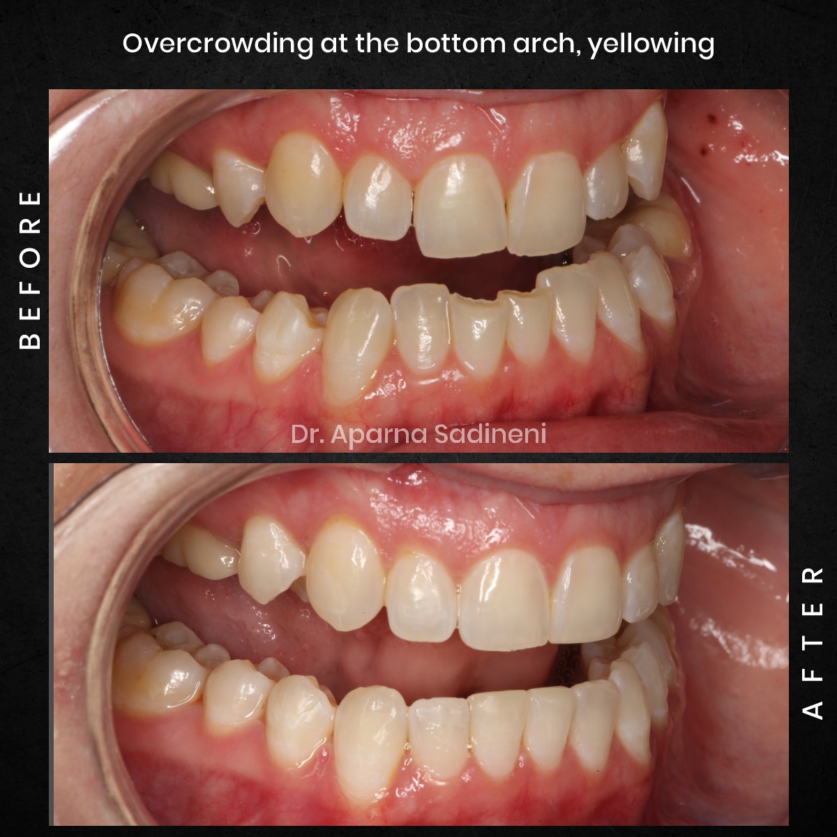 DMD CYCLE 3 POST 3 B&A CAROUSEL AMBER P._2