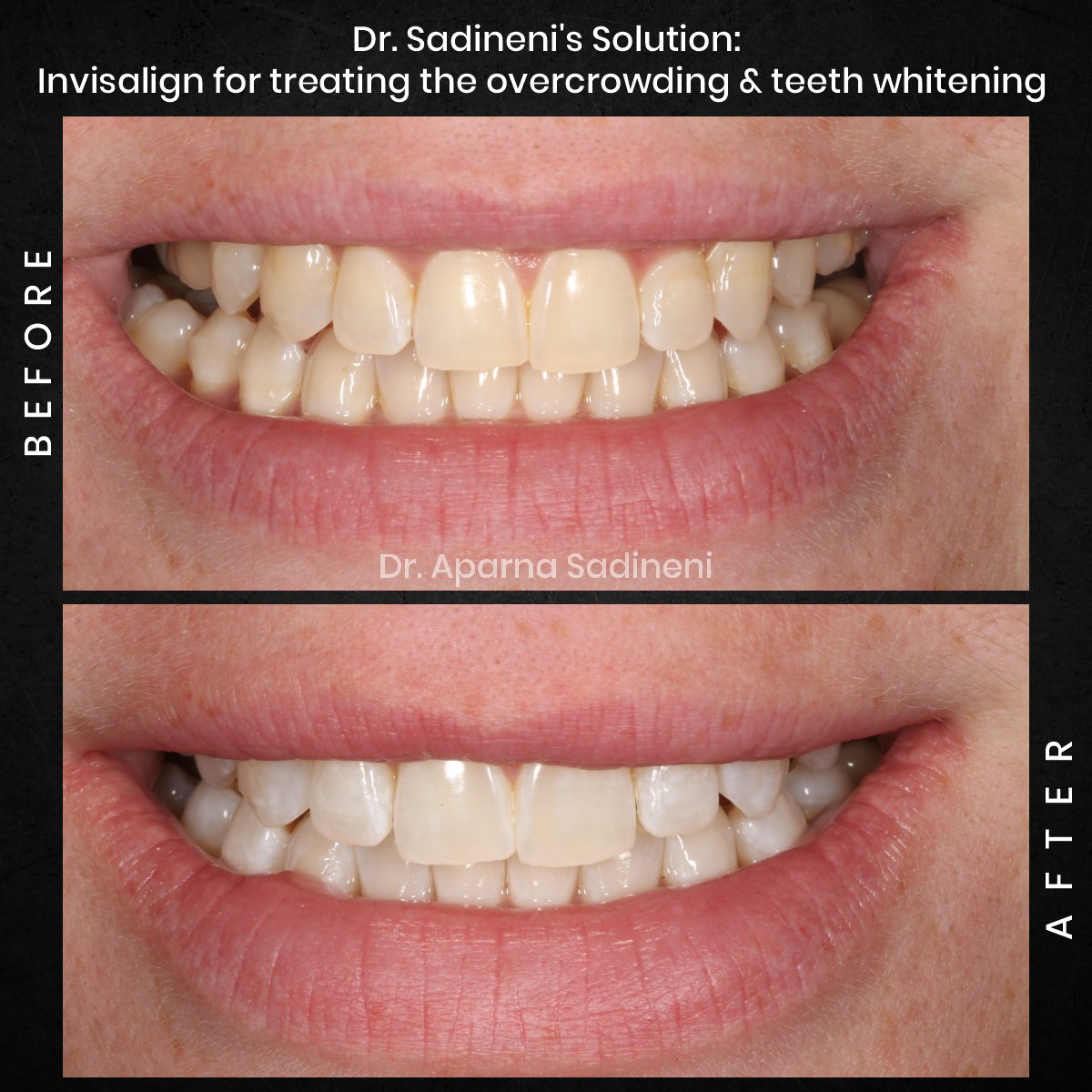 DMD CYCLE 3 POST 3 B&A CAROUSEL AMBER P._3