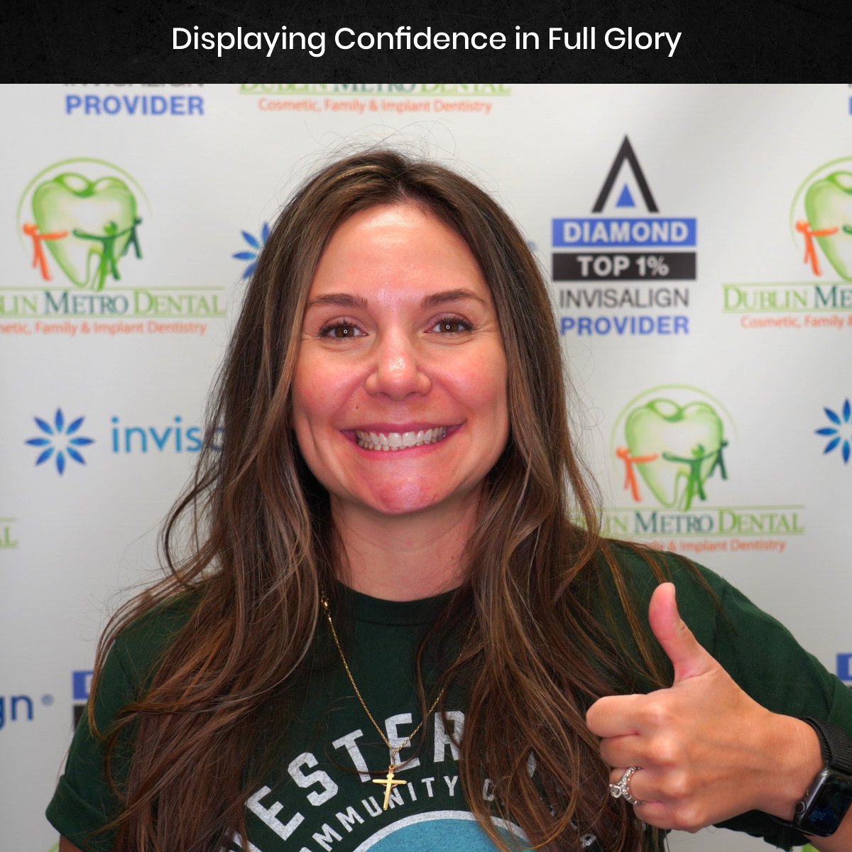 DMD DEC GRID 1 POST 1 TEETH B&A - ALICIA_3