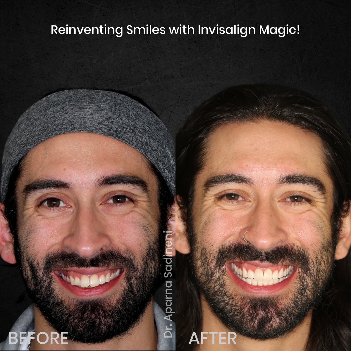 DMD DEC GRID 1 POST 3 HEADSHOT B&A - JOSHUA_1