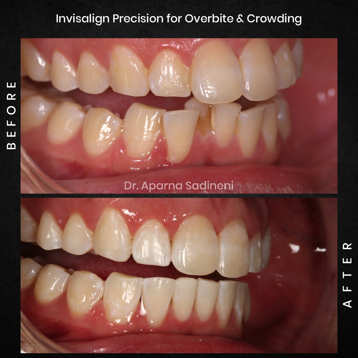 DMD DEC GRID 1 POST 3 HEADSHOT B&A - JOSHUA_4
