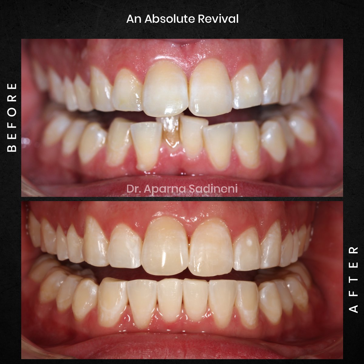 DMD DEC GRID 1 POST 3 HEADSHOT B&A - JOSHUA_5
