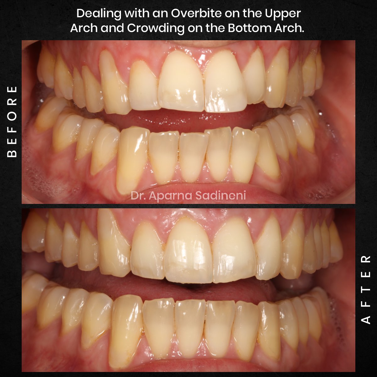 DMD NOV GRID 1 POST 3 - HEADSHOT B&A FRANCESCO_2