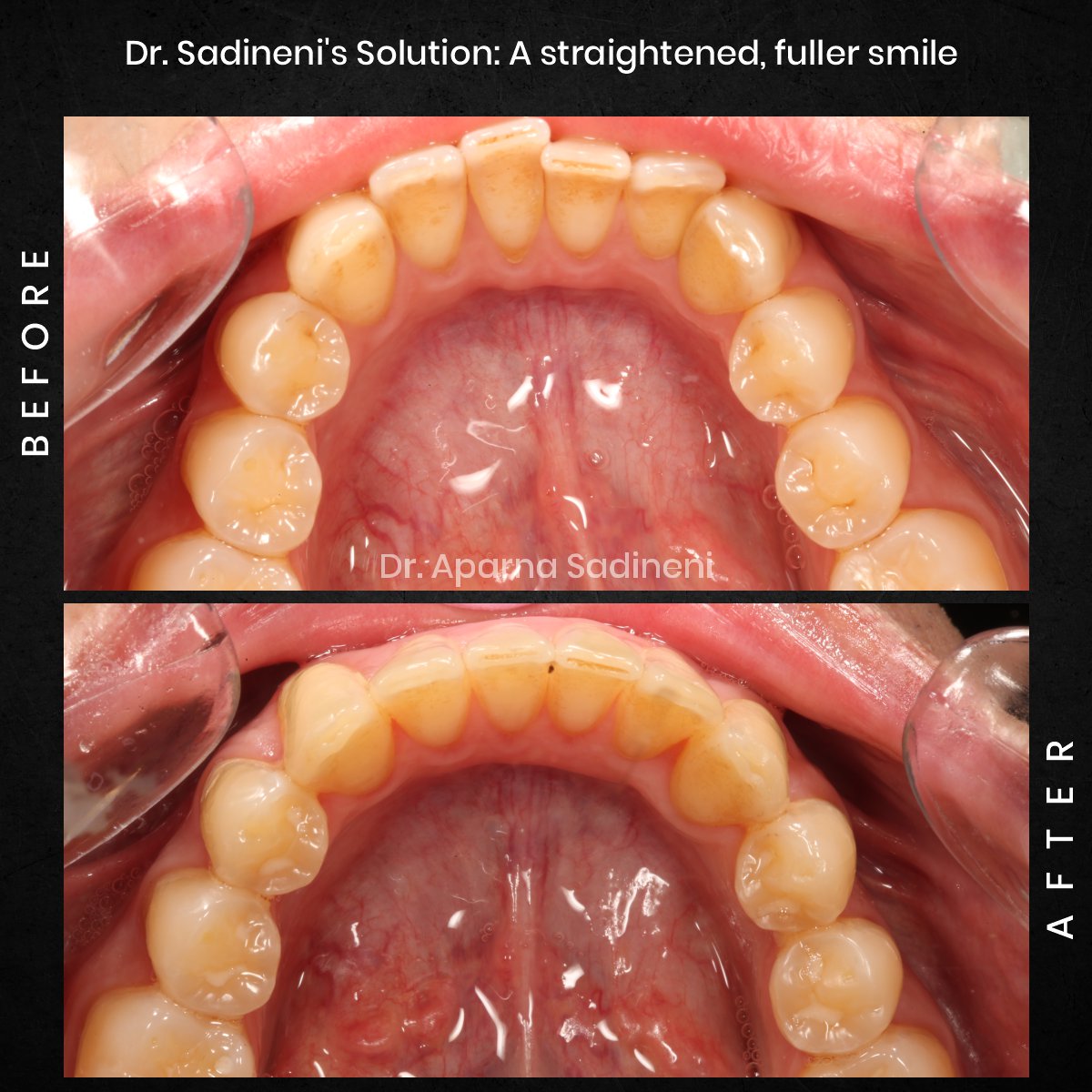 DMD NOV GRID 1 POST 3 - HEADSHOT B&A FRANCESCO_3