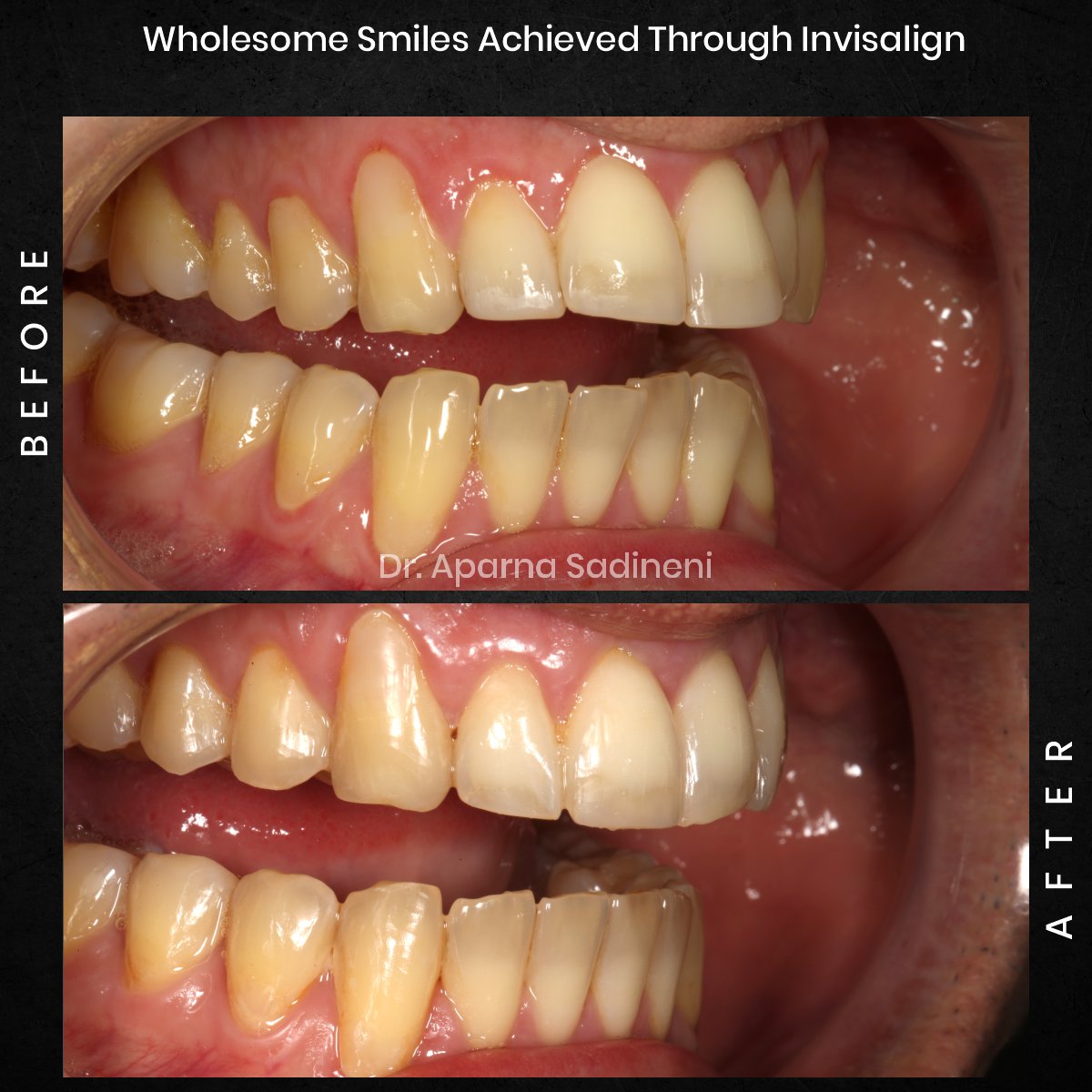 DMD NOV GRID 1 POST 3 - HEADSHOT B&A FRANCESCO_4