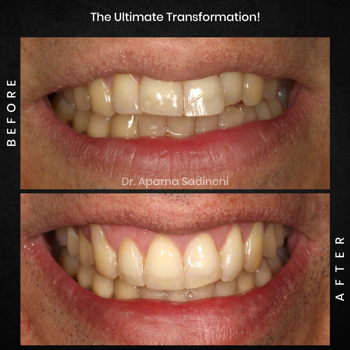 DMD NOV GRID 1 POST 3 - HEADSHOT B&A FRANCESCO_5