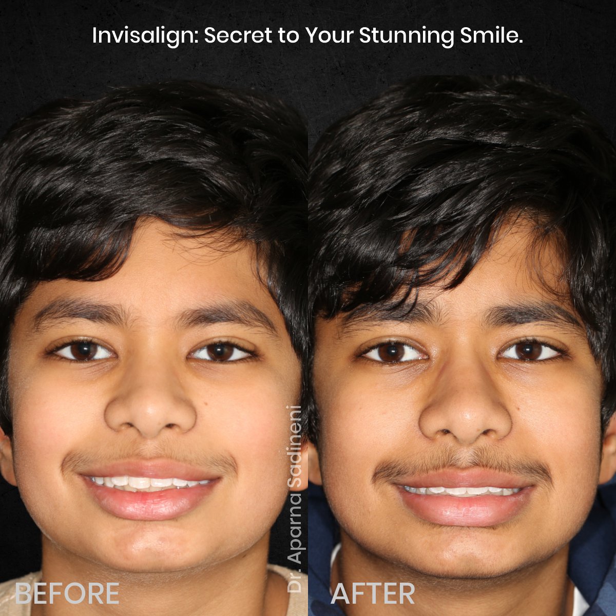 DMD NOV GRID 3 POST 5 - HEADSHOT B_A ARUSH_1 (1)