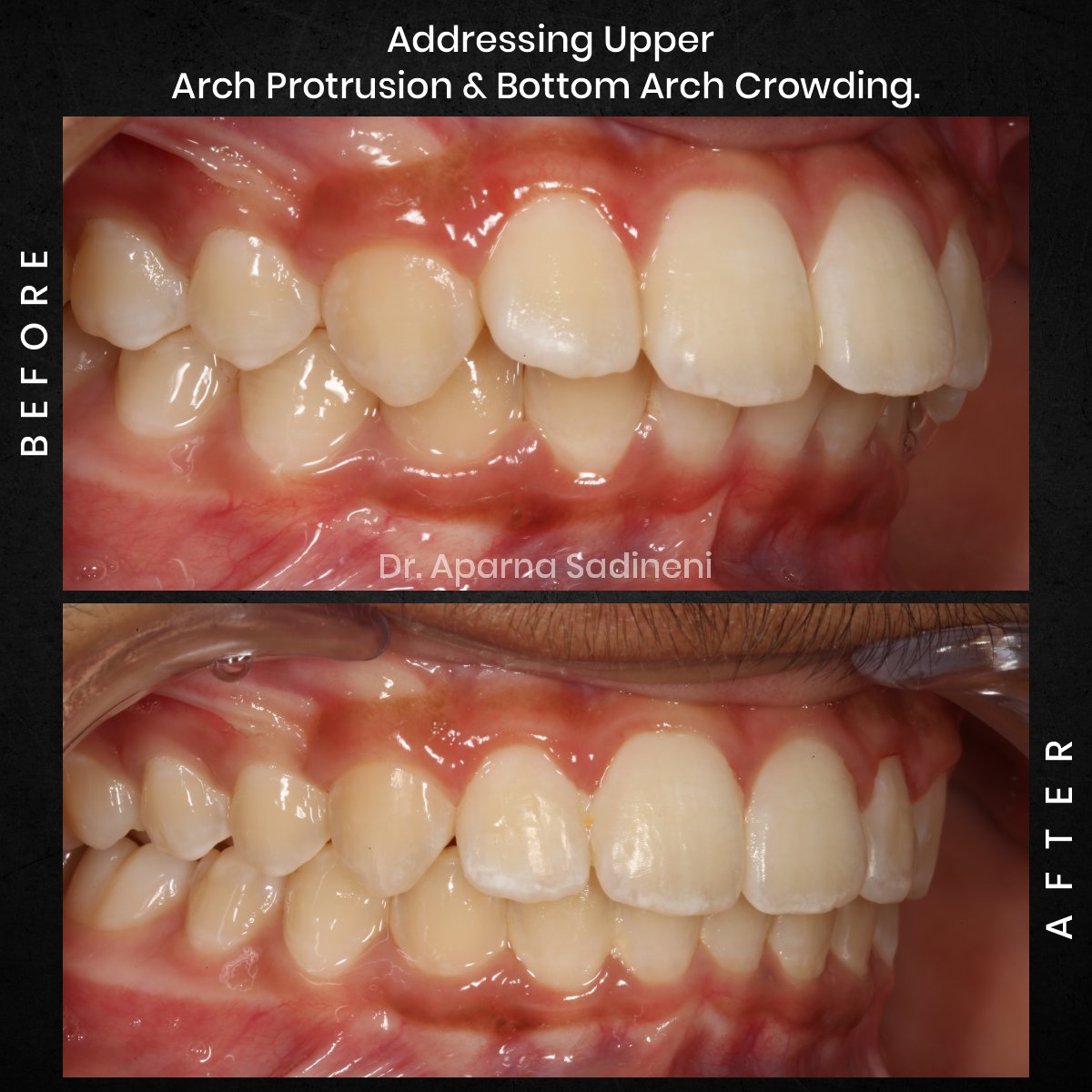 DMD NOV GRID 3 POST 5 - HEADSHOT B_A ARUSH_2 (1)