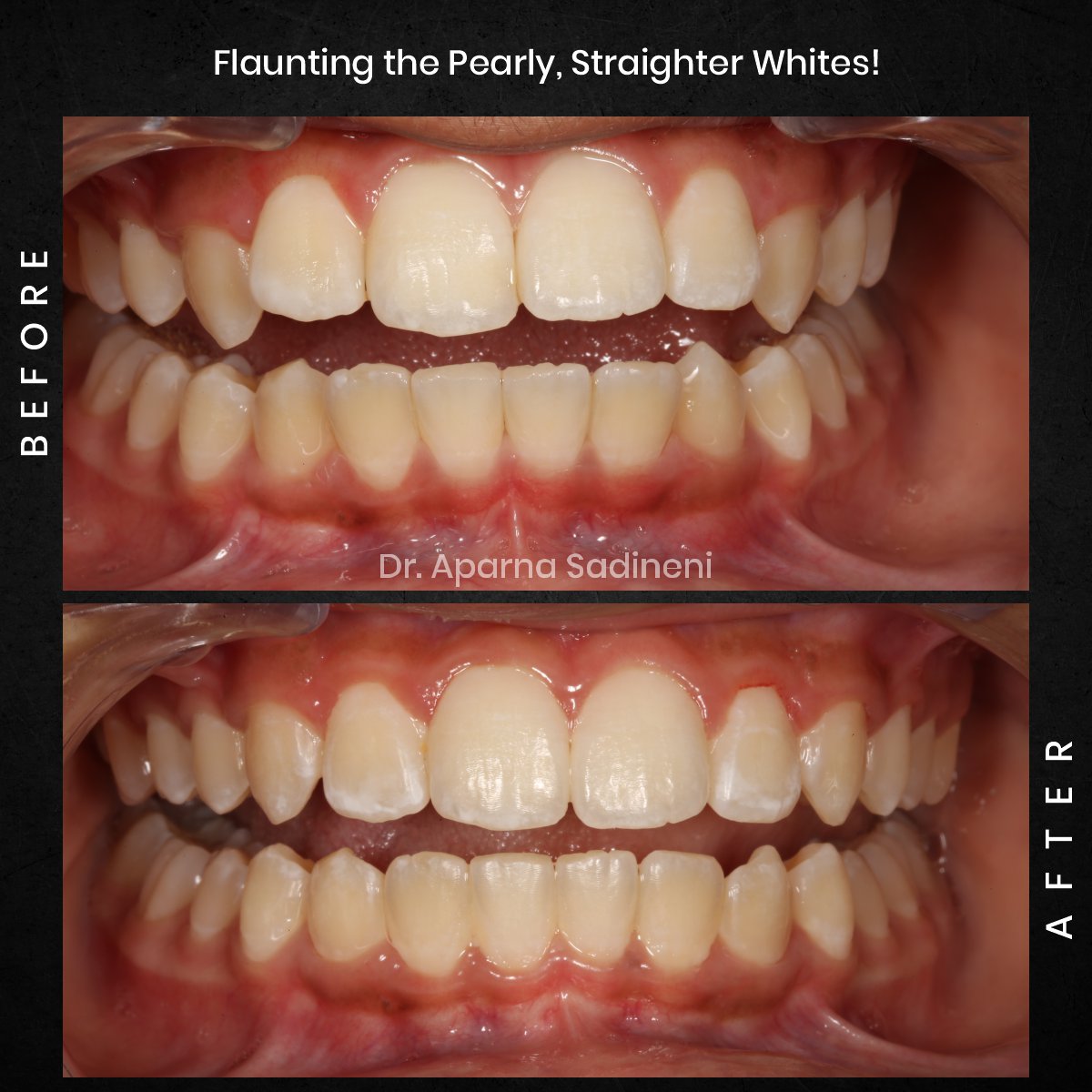 DMD NOV GRID 3 POST 5 - HEADSHOT B_A ARUSH_5 (1)