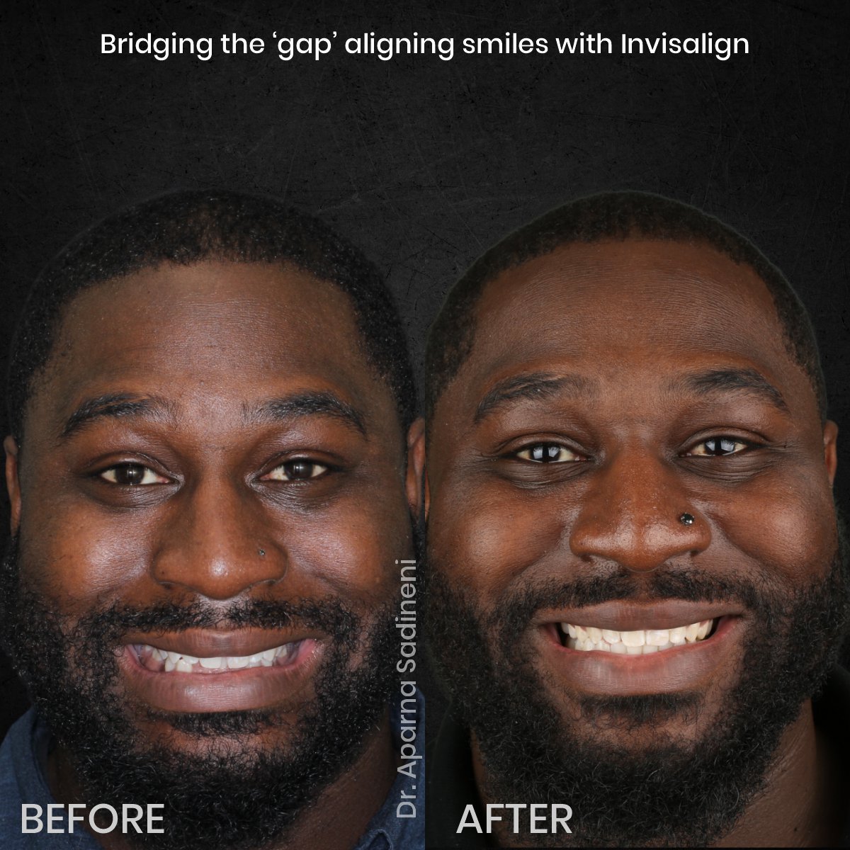 DMD OCT GRID 1 B_A DEARIUS_1