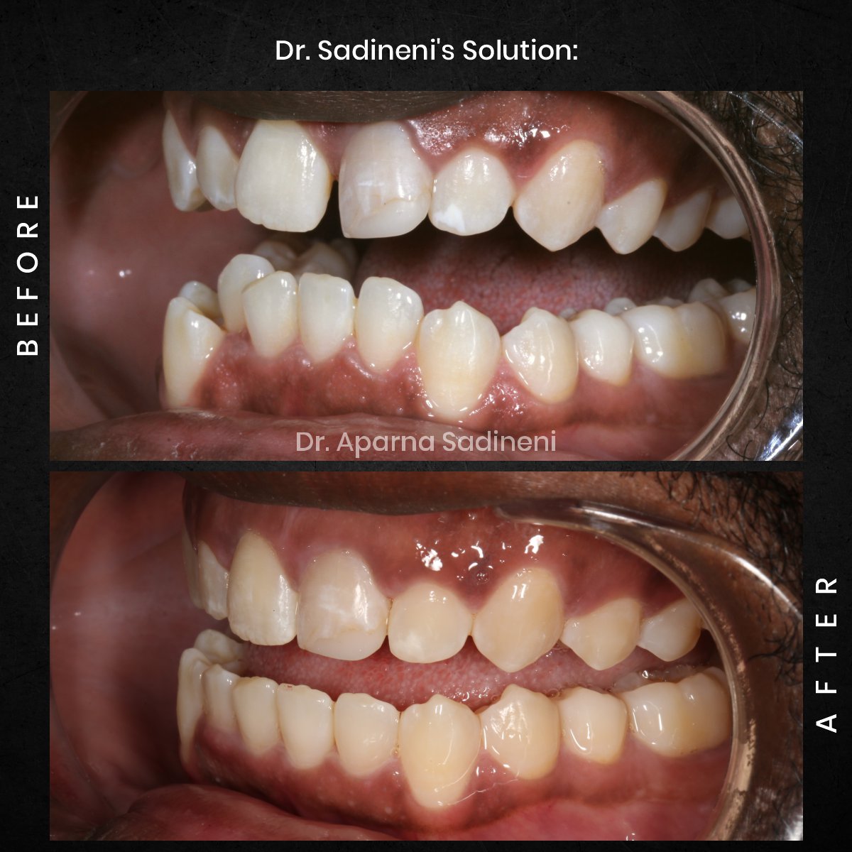 DMD OCT GRID 1 B_A DEARIUS_3