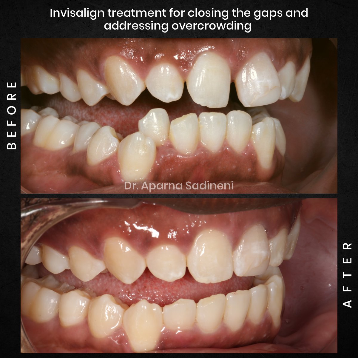 DMD OCT GRID 1 B_A DEARIUS_4