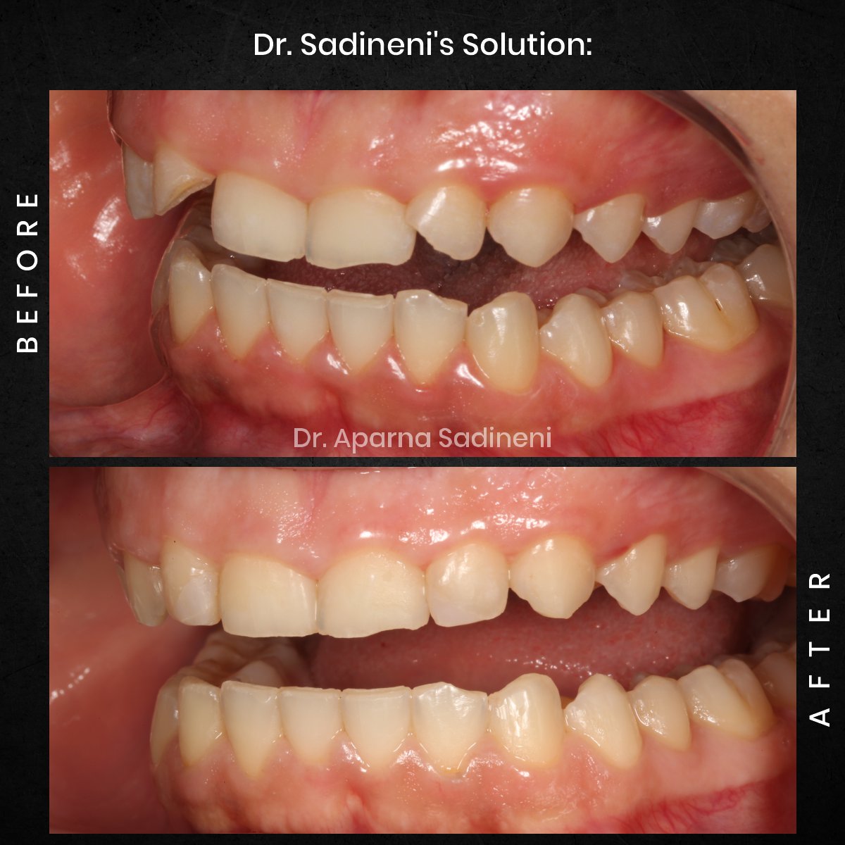 DMD OCT GRID 4 B&A HEADSHOT - MORGANE_3