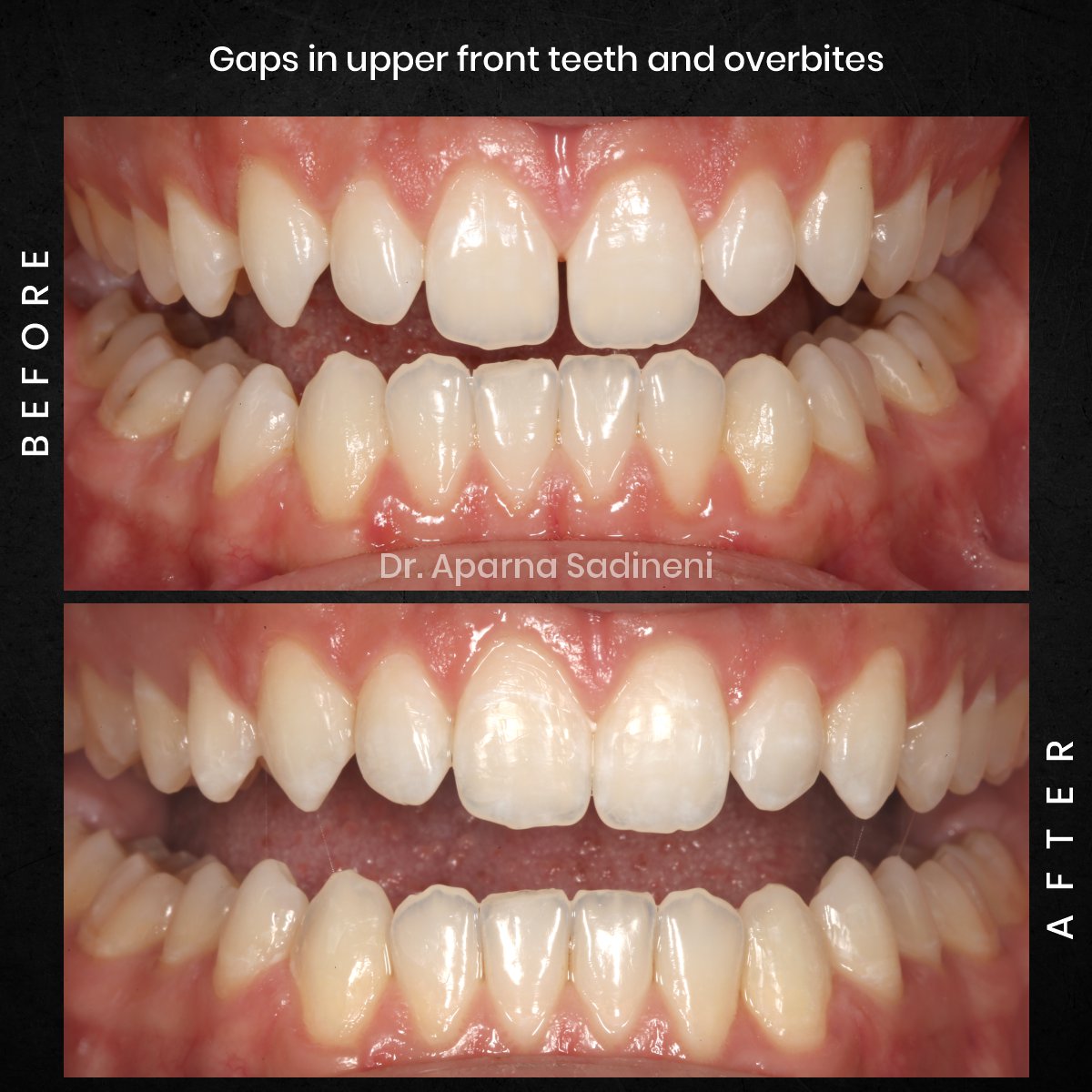 DMD OCT GRID 4 B&A TEETH CAROUSEL - Esam Dobal-1
