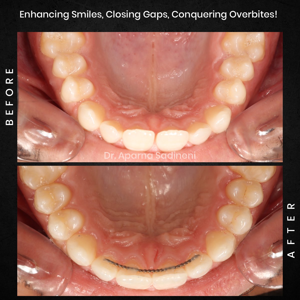 DMD OCT GRID 4 B&A TEETH CAROUSEL - Esam Dobal-2