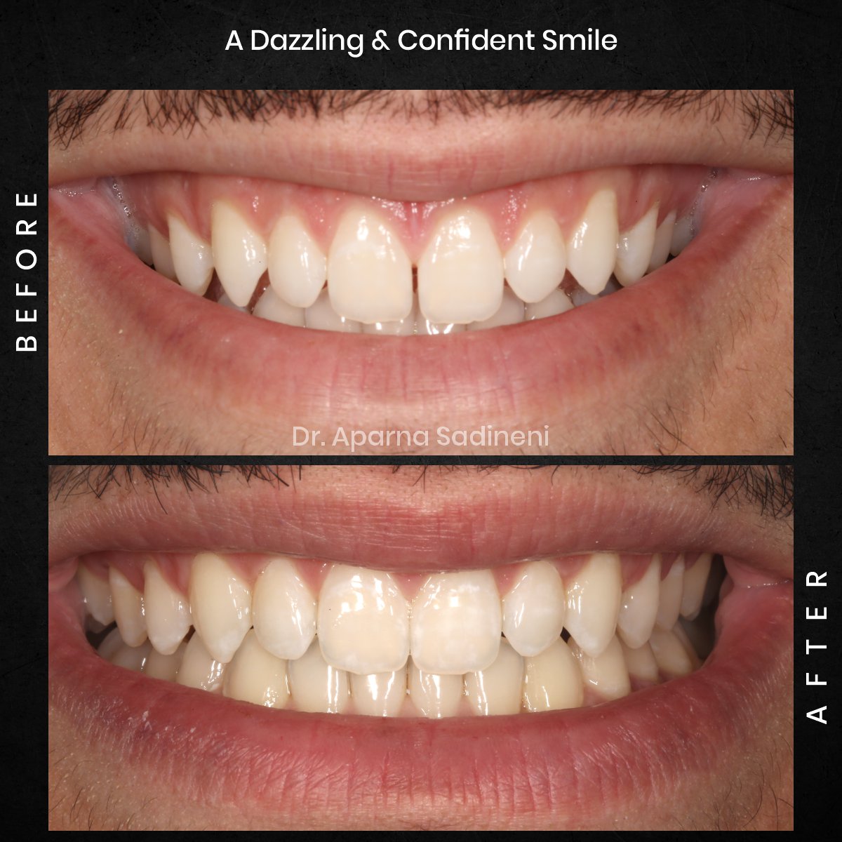 DMD OCT GRID 4 B&A TEETH CAROUSEL - Esam Dobal-4