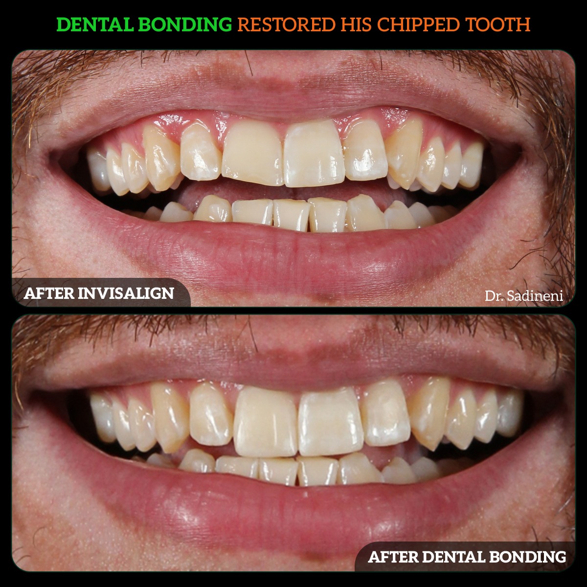 WhatsApp Image 2024-05-23 at 7.04.20 PM